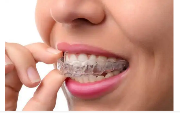 激光打标机如何在牙套标注日期溯源? 激光打标机如何在牙套标注日期溯源?