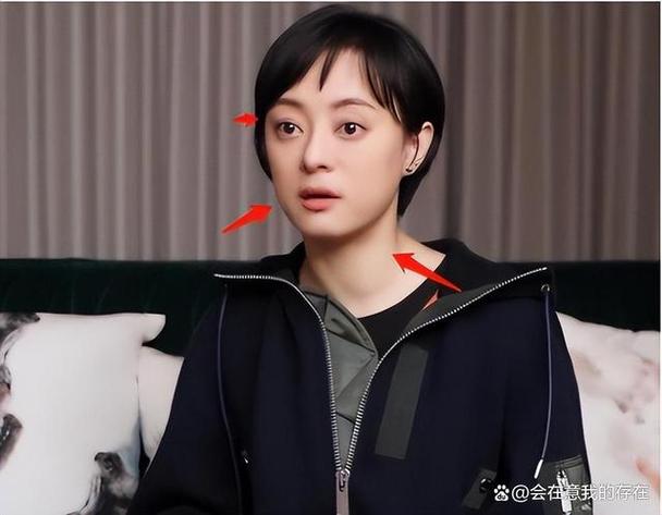 4949澳门特马今晚开奖53期今和孙俪唇下痣没了与孙俪嘴唇的痣